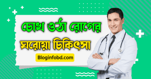 চোখ ওঠা রোগের ঘরোয়া চিকিৎসা